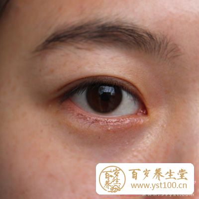 还会伴有眼睑有屑状物剥落的情况